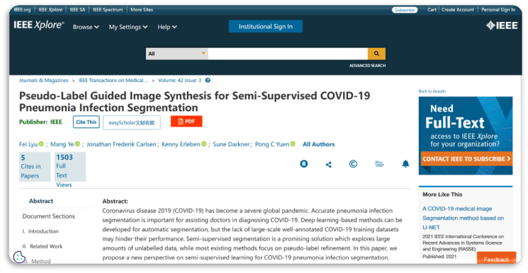 Pseudo-label guided image synthesis for semi-supervised covid-19 pneumonia infection segmentation logo